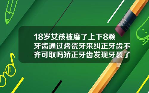 18岁女孩被磨了上下8颗牙齿通过烤瓷牙来纠正牙齿不齐可取吗矫正牙齿发现牙裂了